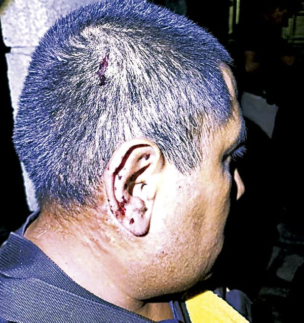 ¡ATACAN A LA POLICÍA! - LE LANZAN EXPLOSIVO DESDE UN DRON