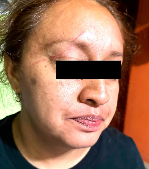 ¡DENUNCIAN A LA POLICÍA DE SOLEDAD DE DOBLADO!