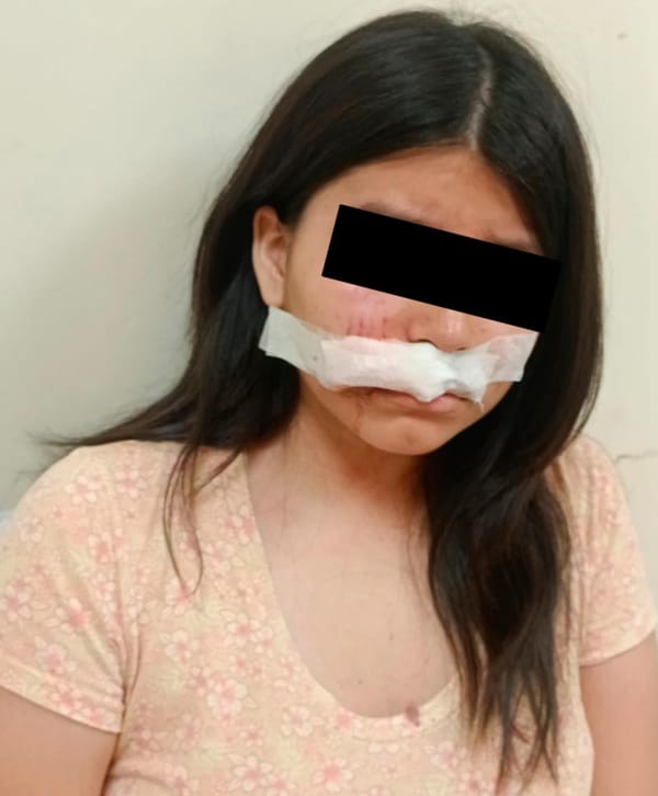 ¡DENUNCIAN A INTEGRANTES DE ‘FINANCIERA’ POR AGREDIR CON UNA PIEDRA A MENOR DE EDAD!