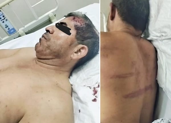 ¡SALVAJE GOLPIZA A CIRINO RAMÓN EX COMANDANTE DE LA FUERZA CIVIL!