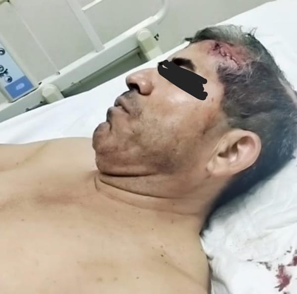 ¡EX COMANDANTE DE LA FUERZA CIVIL ESTÁ DETENIDO POR DESCALABRAR A MUJER POLICÍA!