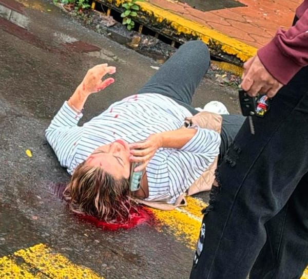 ¡JOVEN AUTOMOVILISTA ARROLLÓ A DOÑA GABRIELA!