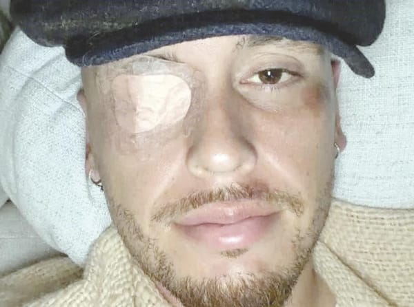 ¡PRESENTA OCAMPOS PARÁLISIS FACIAL!; ADIÓS PRETEMPORADA!