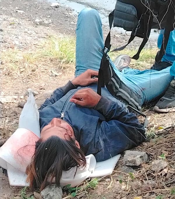 ¡CAMIÓN DE PERSONAL IMPACTÓ A MOTOCICLISTA Y CASI LO MATA!