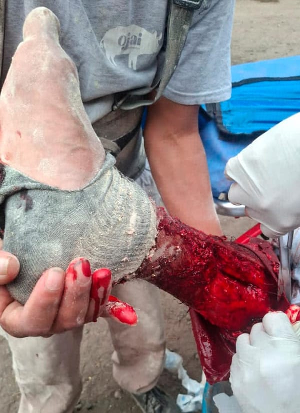 ¡OBRERO CAE EN MOLINO Y CASI PIERDE EL PIE!