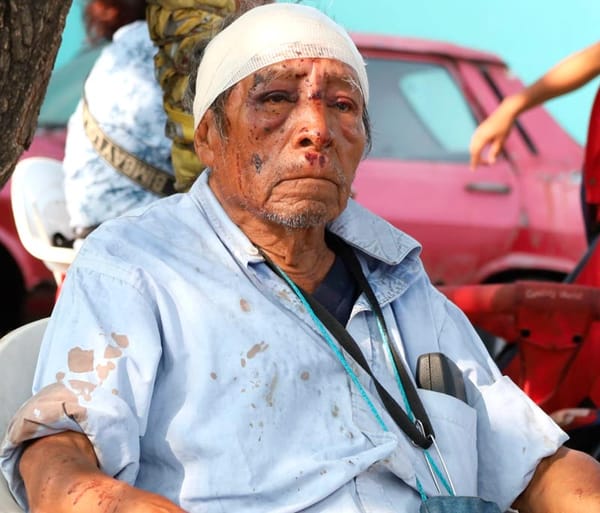 ¡LE DAN SALVAJE GOLPIZA A DON MIGUELITO!